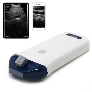 <span class=keywords><strong>Probe</strong></span> Wifi Tipe 10-14MHz L25 Wireless High Frequency Color Doppler <span class=keywords><strong>Ultrasound</strong></span> - Product Image 2