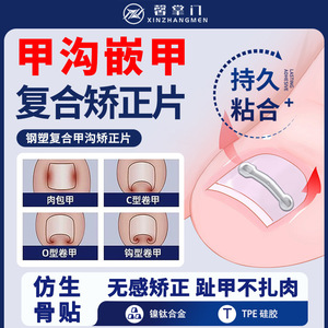 [Xin Zhangmen] Corrector de Uñas Encarnadas de Acero y Plástico Compuesto * Set/Caja al por Mayor para Uñas Encarnadas - Product Image 3