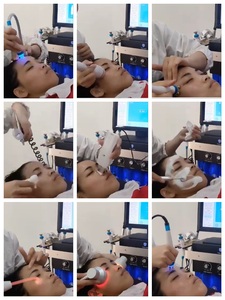 Máquina Facial 14 en 1 de Hidro Microdermoabrasión con Oxígeno, Limpieza Facial, Cuidado de la Piel, Hidradermoabrasión - Product Image 2