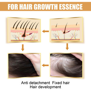 <b>Hair</b> Serum Anti-<b>hair</b> Loss Nourishing Fermented Rice Water Is Used for <b>Hair</b> Growth Treatment. - Product Image 5