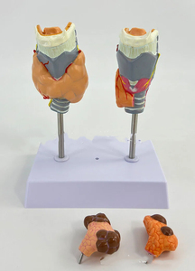 Modelo Anatómico de Tiroides Patológico Humano, Hipertiroidismo, Hipotiroidismo, Sistema Endocrino, Anatomía Médica, Tiroides, Garganta - Product Image 3