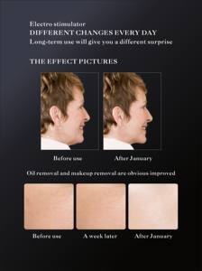 Beco alat pijat Bio Revitalisasi wajah, perangkat perawatan kecantikan pribadi dengan colokan US/IT/ZA, penghilang keriput meremajakan kulit, pemijat wajah - Product Image 4