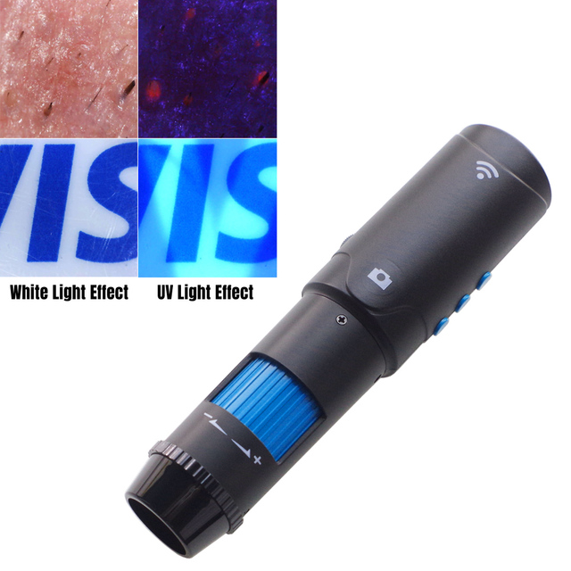 Real 2MP Output UV Dermatoscope with 400nm UV Light Especially Good for Inflamed Skin Detector