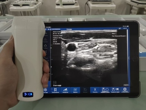 Échographe Doppler Couleur Numérique Sans Fil Vétérinaire WIFI 7.5/10MHZ Linéaire avec 192 Éléments pour la Thérapie des Petits Organes Humains MSK - Product Image 3