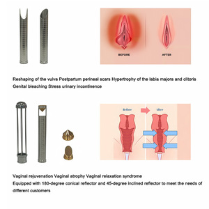 Laser Co2 2024 fraksional Laser peremajaan kulit, Laser pelapis pengencang vagina medis Rf 10600Nm 70W - Product Image 6
