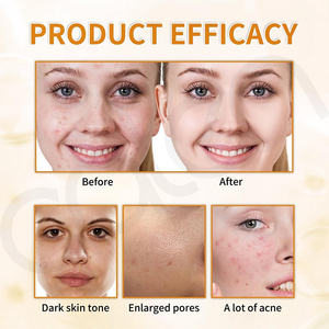 Oalen Private Label Facial Exfoliating Toner Daily Brightening Treatment Reduces Uneven <strong>Marks</strong> for Nice Skin Tone - Product Image 4