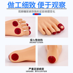 Modelo de cuidado del pie para diabéticos; modelo de lesiones del pie en pacientes diabéticos; cambios patológicos del pie; modelo de pie. - Product Image 4