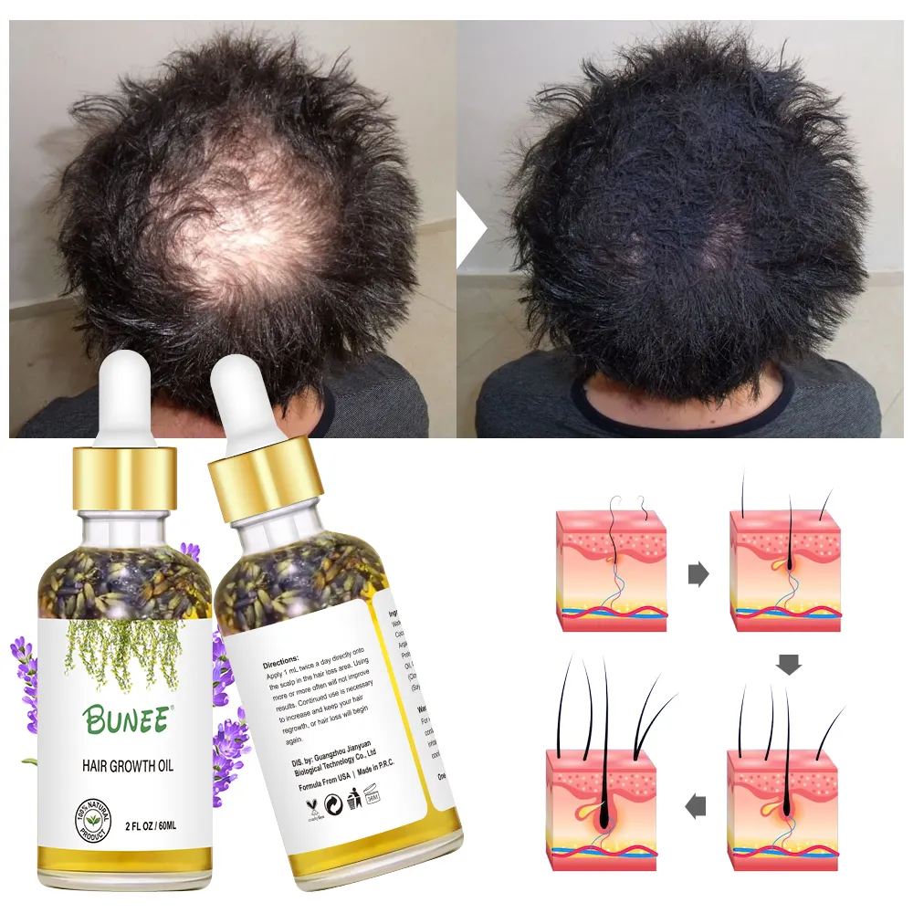 Aceite de lavanda para el crecimiento del cabello, suero orgánico para el crecimiento del cabello, con tu propia etiqueta