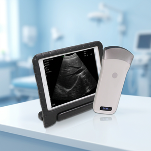 Escáner de Ultrasonido Convexo Inalámbrico Portátil y Económico en Blanco y Negro UProbe-3C para Abdomen y Obstetricia - Product Image 1