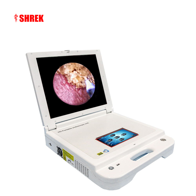 Digital Colposcope hd Vagina Portable Endoscope and Portable Kidney Stones Endoscope