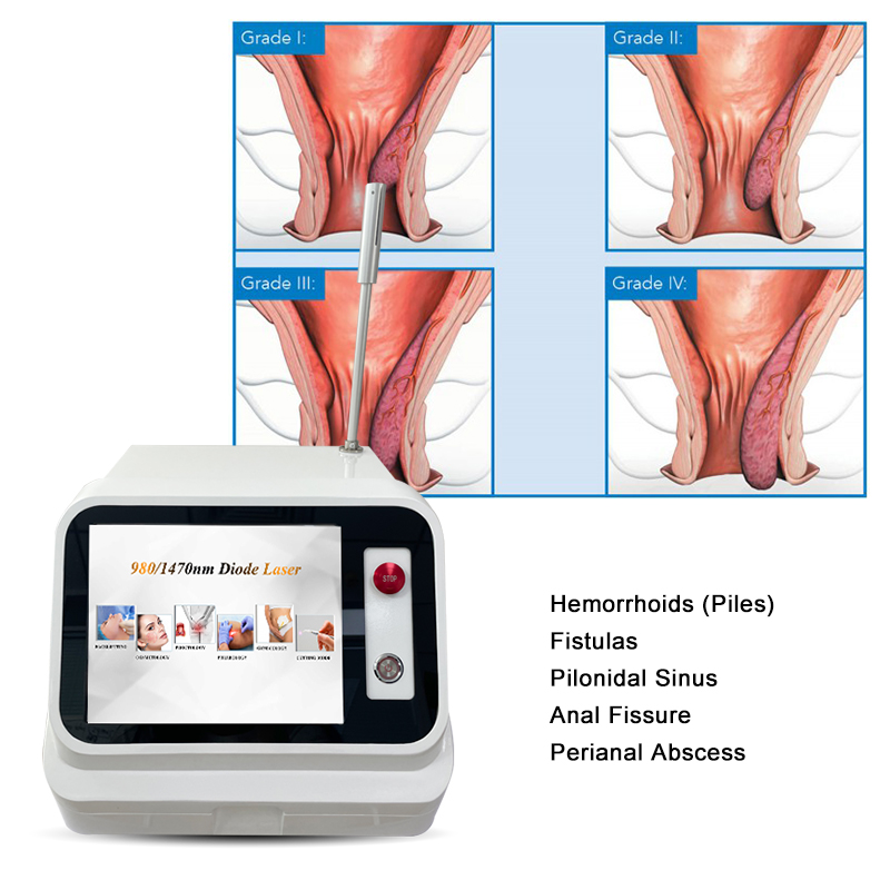Professional Dr Use 980 1470 External Hemorrhoid Treatment Machine