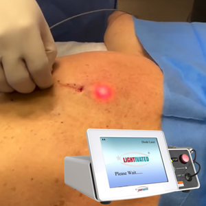 Láser Facial Endolaser 980 1470nm Lipo anticelulítico lipólisis diodo láser Estiramiento facial estiramiento de la piel máquina de liposucción de barbilla - Product Image 1