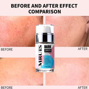 <span class=keywords><strong>เซ</strong></span><span class=keywords><strong>รั่</strong></span><span class=keywords><strong>ม</strong></span>แก้จุดด่างดำ30<span class=keywords><strong>ม</strong></span>ล. น้ำยากำจัดจุดด่างดำปากแข็งกรดโคจิกอัลฟาอาร์บูตินเพื่อควา<span class=keywords><strong>ม</strong></span>งา<span class=keywords><strong>ม</strong></span>ฉลากส่วนตัว - Product Image 4