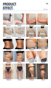 Alat Kecantikan Pembentuk Tubuh Pelangsing Pijat Roller Bola Dalam 8D Kecepatan Tinggi dengan 2 Gagang untuk Tubuh dan Wajah - Product Image 6