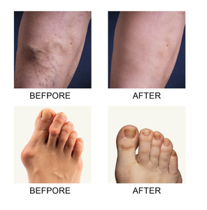 Crema de Colágeno para Articulaciones y Huesos, Mejora el Metabolismo Óseo y Alivia la Hinchazón y el Dolor Articular, al Mejor Precio - Product Image 3