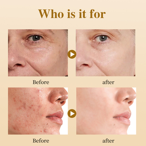 Essência de Cuidados com a Pele Natural de Marca Privada Reparação de Poros Iluminação Anti-Idade Hidratante Clareador Acne Sérum Facial com Própolis - Product Image 5