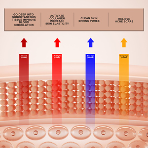 Nouvel ensemble de soins anti-âge 2026 : Gommage visage et corps, masque en silicone, masque facial anti-âge à domicile, appareil de traitement de l'acné - Product Image 5
