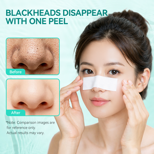 BREYLEE มาส์กทีทรี แบล็คเฮด 20 มล. มาส์กแบบลอกออกสำหรับจมูก ทำความสะอาดล้ำลึก ขจัด<span class=keywords><strong>สิว</strong></span>หัว<span class=keywords><strong>ดำ</strong></span>ฝังลึก ควบคุมความมัน ทำความสะอาดรูขุมขน - Product Image 5