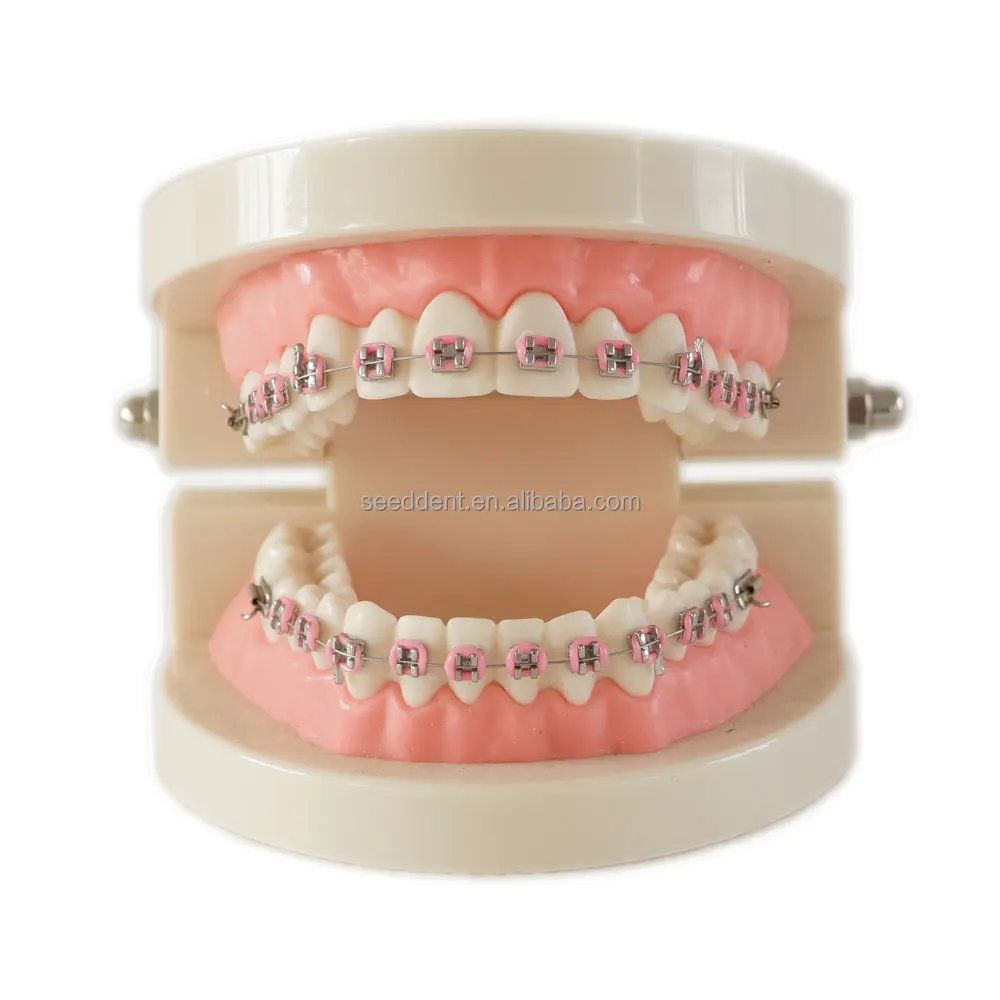 Tandheelkundige Orthodontische Behandeling Model Met Ortho Metalen Keramische Beugel/28Pcs Orthodontische Dental Tanden Model