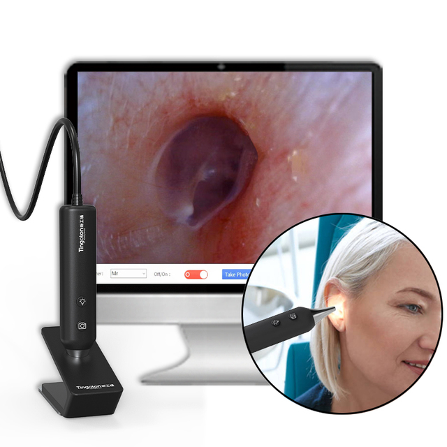 Tingoton Black/White Digital Ear Endoscope Camera USB3.0 1280x720 30FPS Adjustable LED Light Source Compatible Windows/MAC