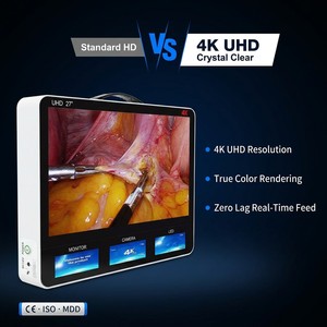 Sistema de Cámara Quirúrgica Portátil Todo en Uno Ocean 4K UHD con Pantalla Táctil, Grabador de Video, Laparoscopia, ORL, Artroscopia P 002 Ocean 4K U - Product Image 5