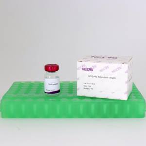 Antigène multivalent prêt à l'emploi pour le test de plaque rapide typhoïde Pullorum et volaille (certifié ISO) - Product Image 1