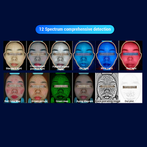 โปรโมชั่น เครื่องวิเคราะห์ผิวหน้า 8 ล้านพิกเซล พร้อมระบบสแกนใบหน้าด้วย AI ตรวจสอบสภาพผิวด้วยแสง UV และเครื่องวิเคราะห์ผิวหน้า 3 มิติ - Product Image 4