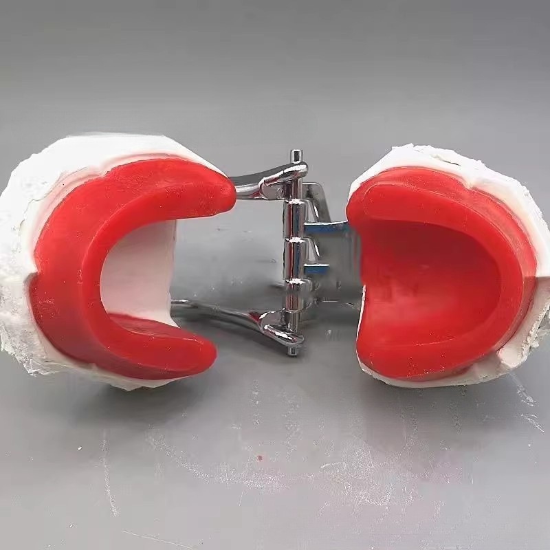 Canaux de cire rouge pour edentulie, plâtre et cadre occlusal