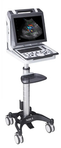 Ecógrafo Doppler Color Portátil Veterinario SIUI Apogee 2300, Máquina de Ultrasonido 4D para Hospitales de Mascotas y Animales - Product Image 5