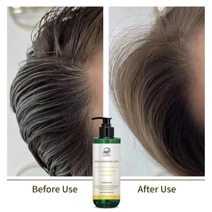 Shampoo pour cheveux gras, shampooing volumisant pour cheveux, fabricant en gros, <span class=keywords><strong>marque</strong></span> chinoise, shampooing pour hommes et femmes - Product Image 2
