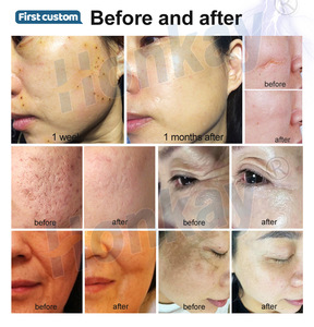 Appareil professionnel au plasma 9 en 1 certifié CE, élimination de la pigmentation, nettoyage de la peau, 2 poignées, plasma froid pour spa - Product Image 6