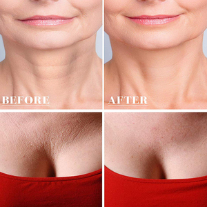 Set di Cuscinetti Antirughe in Silicone per Petto e Collo, 100% Silicone di Grado Medicale, Cuscinetti per la Prevenzione delle Rughe - Product Image 5