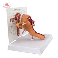 Modèle d'utérus, modèle anatomique, organes reproducteurs féminins, anatomie pathologique, modèle humain, sciences médicales