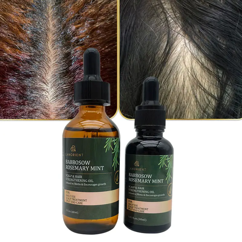 OEM olio di menta al rosmarino 60ml Organics uomo donna nutre l'olio per capelli per la cura dei capelli per la crescita