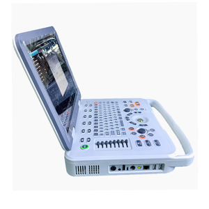 Alat Diagnostik Gigi dan Hewan Peliharaan Portabel Multi-Fungsi B-<span class=keywords><strong>Scan</strong></span> Color Doppler <span class=keywords><strong>Ultrasound</strong></span> - Product Image 2