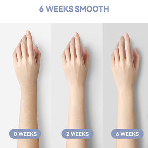 Épilateur électrique IPL portable pour usage domestique avec épilation permanente, étanche IPX5, langues anglaise/<span class=keywords><strong>française</strong></span>, garantie 1 an - Product Image 5