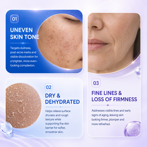 Crema Facial Vegana Orgánica de Marca Privada con Glutatión y <span class=keywords><strong>Vitamina</strong></span> <span class=keywords><strong>E</strong></span> <span class=keywords><strong>para</strong></span> Hidratar, Blanquear y Antienvejecimiento, con Extracto de Rosa Mosqueta - Product Image 2