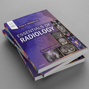 Elementi Essenziali di Radiologia 4a Edizione, Libro di Testo Medico con Copertina Morbida, Stampa Personalizzata con Rilegatura Perfetta - Product Image 5