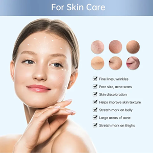 Stylo de massage facial bio en acier inoxydable, stimule la régénération du <span class=keywords><strong>collagène</strong></span> pour lutter contre la perte de cheveux et réduire les ridules périorbitales - Product Image 6