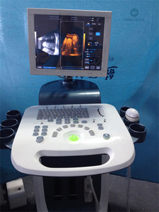 TC15 mesin <span class=keywords><strong>Ultrasound</strong></span>, sistem diagnostik Digital penuh <span class=keywords><strong>3D</strong></span> 4D Trolly warna - Product Image 2