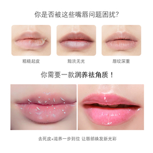 <span class=keywords><strong>Crema</strong></span> exfoliante hidratante para labios, <span class=keywords><strong>crema</strong></span> exfoliante para el cuidado de los labios, Gel de belleza para eliminación de labios - Product Image 2