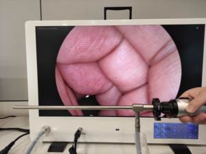 Cámara endoscópica de Urología eléctrica FHD con pantalla <span class=keywords><strong>integrada</strong></span> y almacenamiento de vídeo para uso en cirugía hospitalaria - Product Image 6