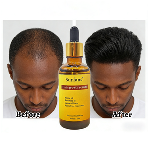 Olio Stimolante per la Crescita dei Capelli Personalizzabile 5kg, Biologico, Vegano, con Biotina, Erbe, Menta Piperita e Olio dell'Albero del Tè, Nutriente per Capelli Voluminosi - Product Image 1