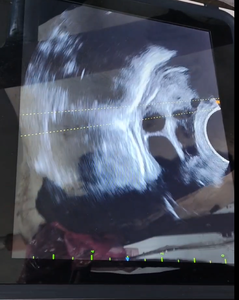 Advanced PT60 OPU para IVF-High Resolution (120dB) <span class=keywords><strong>Cine</strong></span> Loop 200 Frames, Bluetooth Keyboard Ready BMV OPU System Ultrasonido - Product Image 3