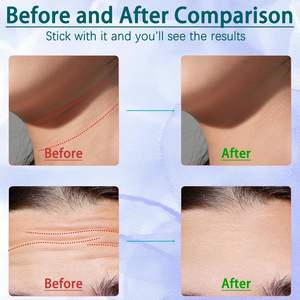 <span class=keywords><strong>Meilleur</strong></span> masseur de visage de cou de qualité professionnelle avec micro-courant et vibration <span class=keywords><strong>pour</strong></span> un retrait efficace du <span class=keywords><strong>double</strong></span> <span class=keywords><strong>menton</strong></span> et un raffermissement de la peau - Product Image 6