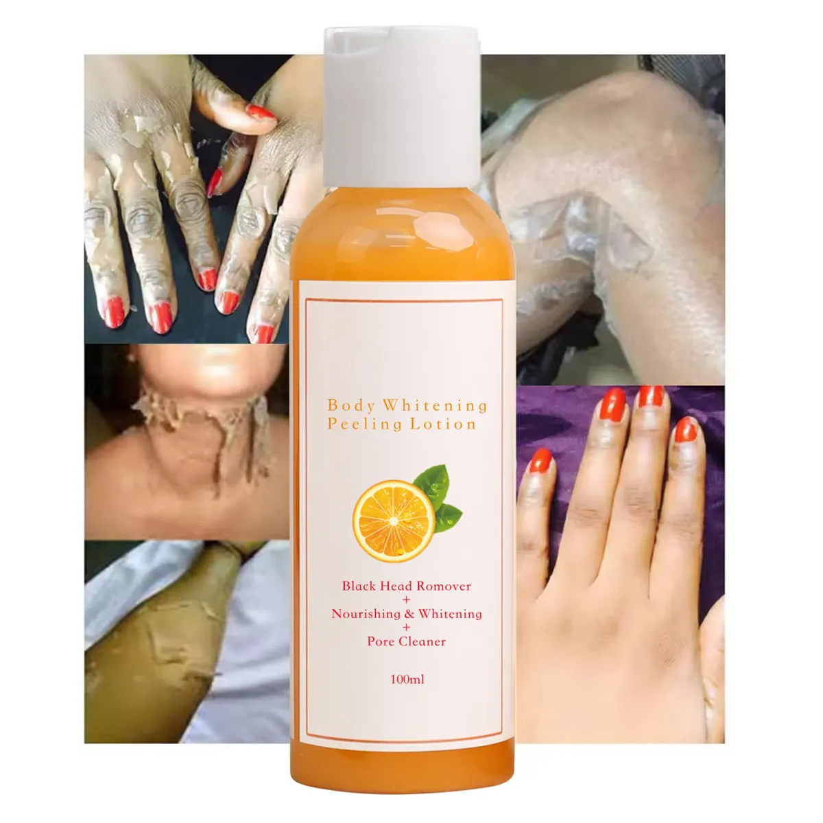 Dark Spot Corrector Remover Dead Skin Most Effective Knuckles Whitening Remove Dead Skin Exfoliating Yellow Orange Peeling Oil