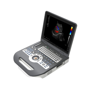 LTUB65 - Escáner de Ultrasonido Portátil a Color de Bajo <span class=keywords><strong>Precio</strong></span>, Sistema de Diagnóstico Médico, Máquina de Ecocardiografía - Product Image 2
