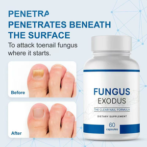 Formula Kuku Bening untuk Kesehatan Kaki dari Jamur, Label Pribadi OEM/ODM, Laris Manis, 60 Kapsul Vegetarian, 2 Kapsul Sehari - Product Image 6