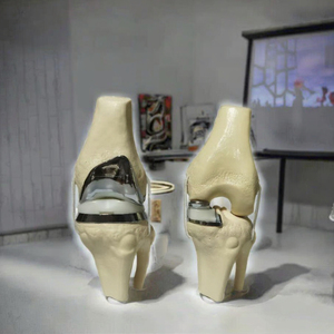 Detachable Knee Joint Implant <b>Model</b> Double Type PVC Anatomical Teaching <b>Model</b> Manikin by Dentavex - Product Image 3