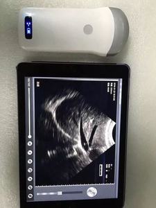 Sonde sans fil Mode B Scanner à ultrasons Équipement médical Scanners vétérinaires à main pour cochon, mouton, chèvre, chien, bétail, ferme et cheval - Product Image 3